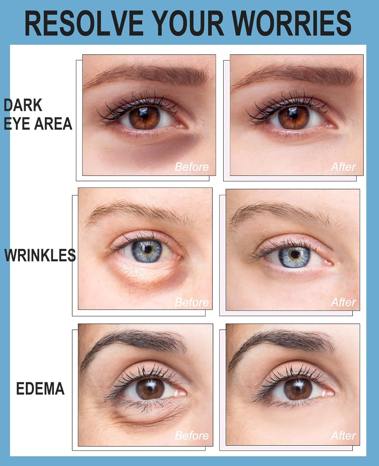 Under Eye Collagen Mask Patches White Color, Under Eye Mask Skincare for Dark Circles and Puffiness