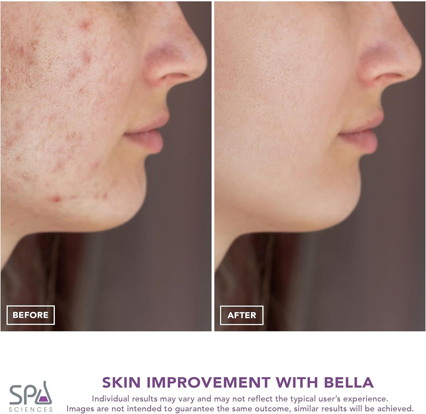 Spa Sciences - BELLA Microderm Pore Extractor & Nano Mister - 3-in-1 - Exfoliation & Pore Purification - Hydrating, Refreshing, Soothing - for All Skin Types - USB Charging