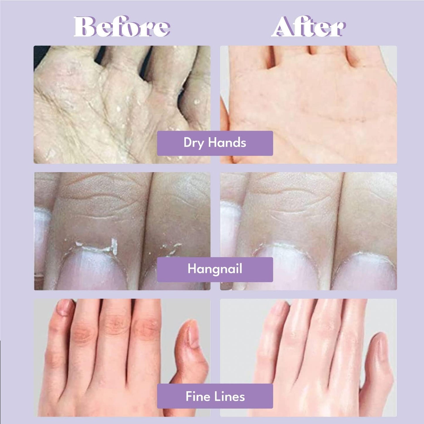 Toi:L Extra Silky Hand Mask 5 Pairs, Korean Moisturizing Gloves for Dry Hands with White Truffle, Green Caviar & Peptides, Repairing and Softening Hand Care Treatment for Aging, Cracked, and Dry Skin