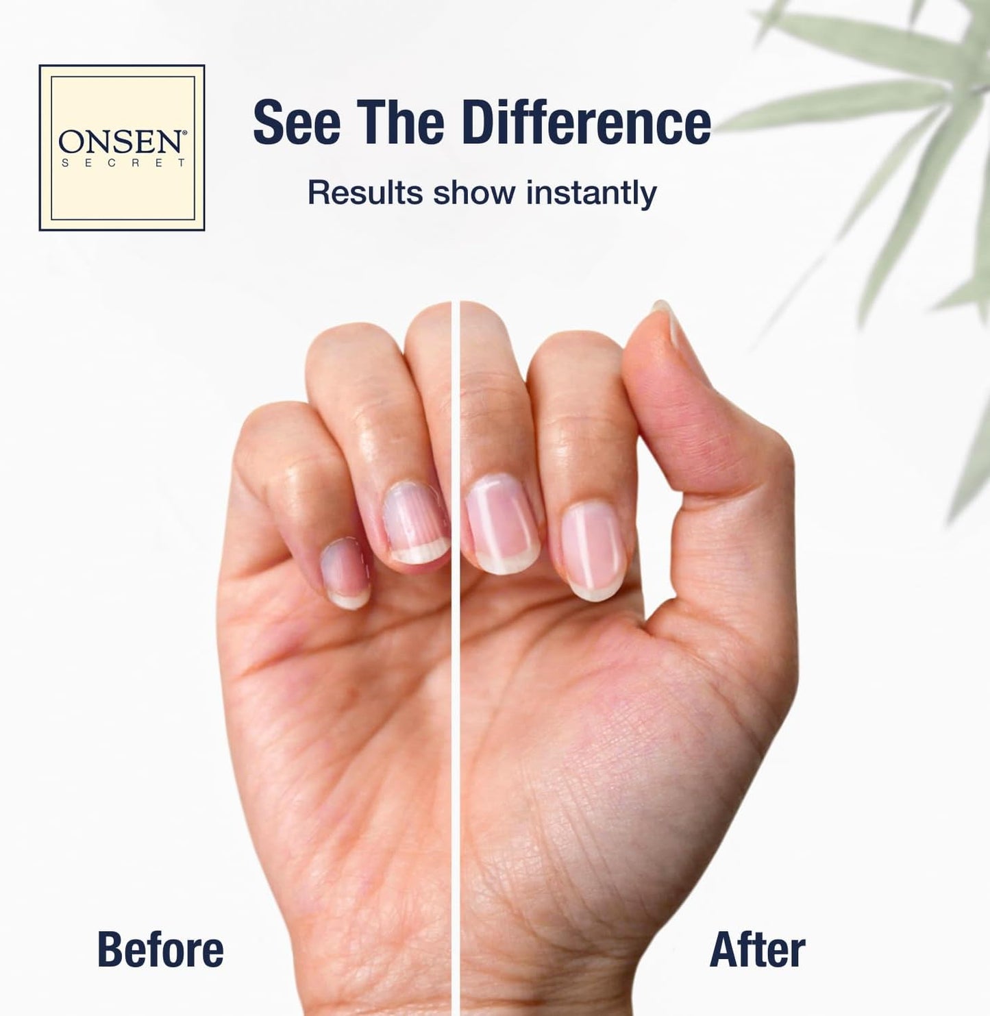 Onsen Secret Ultimate Nail Reboot Kit - Professional Nail File and Buffer, 3-Way Block w/Replacement Pads, Nail Strengthening Cuticle Cream, Reboot Oil & Anti Aging Hand Lotion