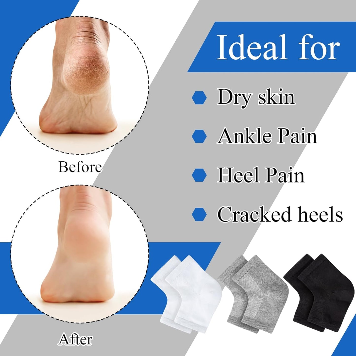 Moisturizing Socks,12 Pairs toeless Socks for Women for Dry Cracked Heel Treatment,Cracked Heel,msilicone Socks for Women