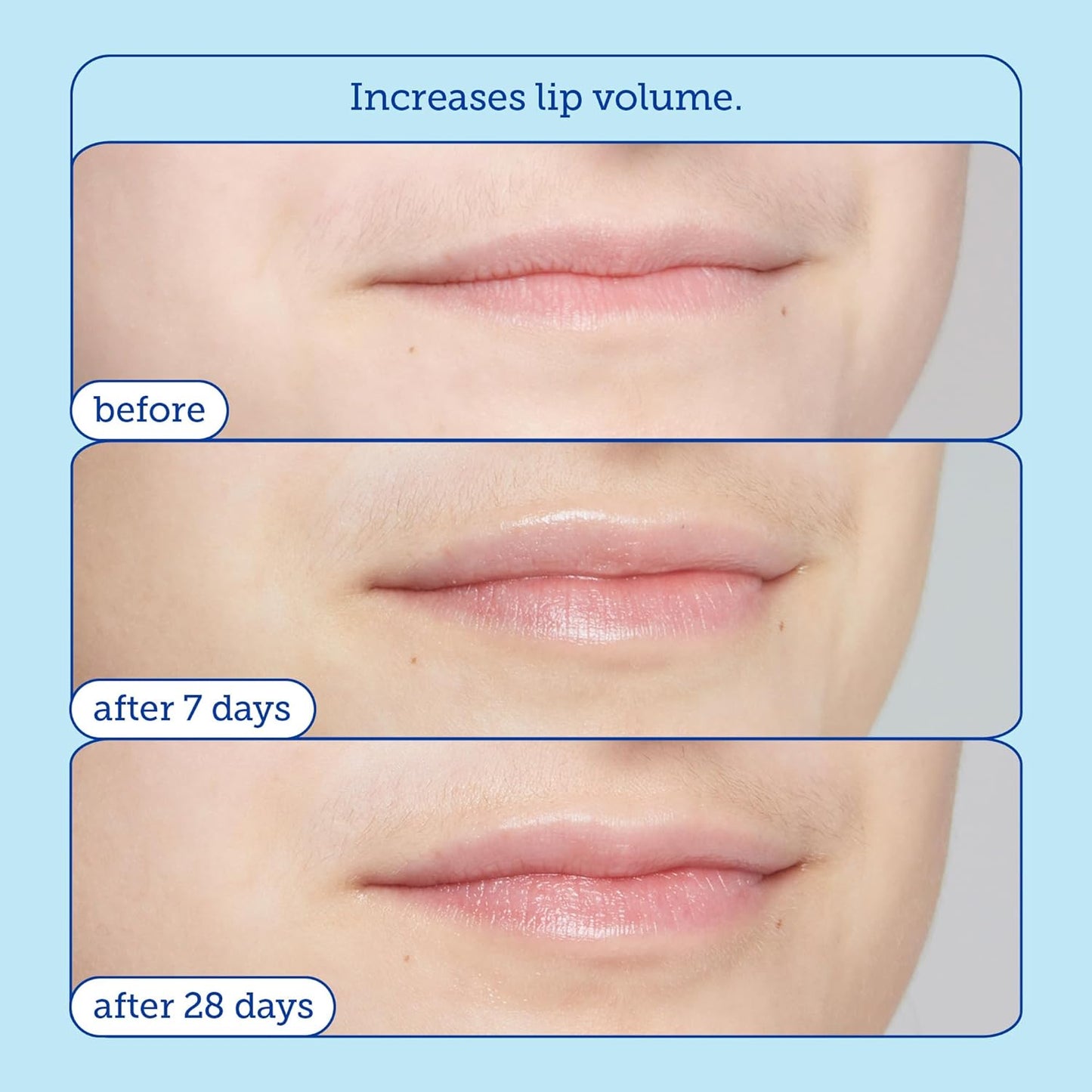 Skinfix Barrier+ Triple Lipid Lip Treatment: Nourish Dry, Chapped Lips With Our Volumizing Complex to Visibly Plump & Fill Fine Lines, 0.27 Oz