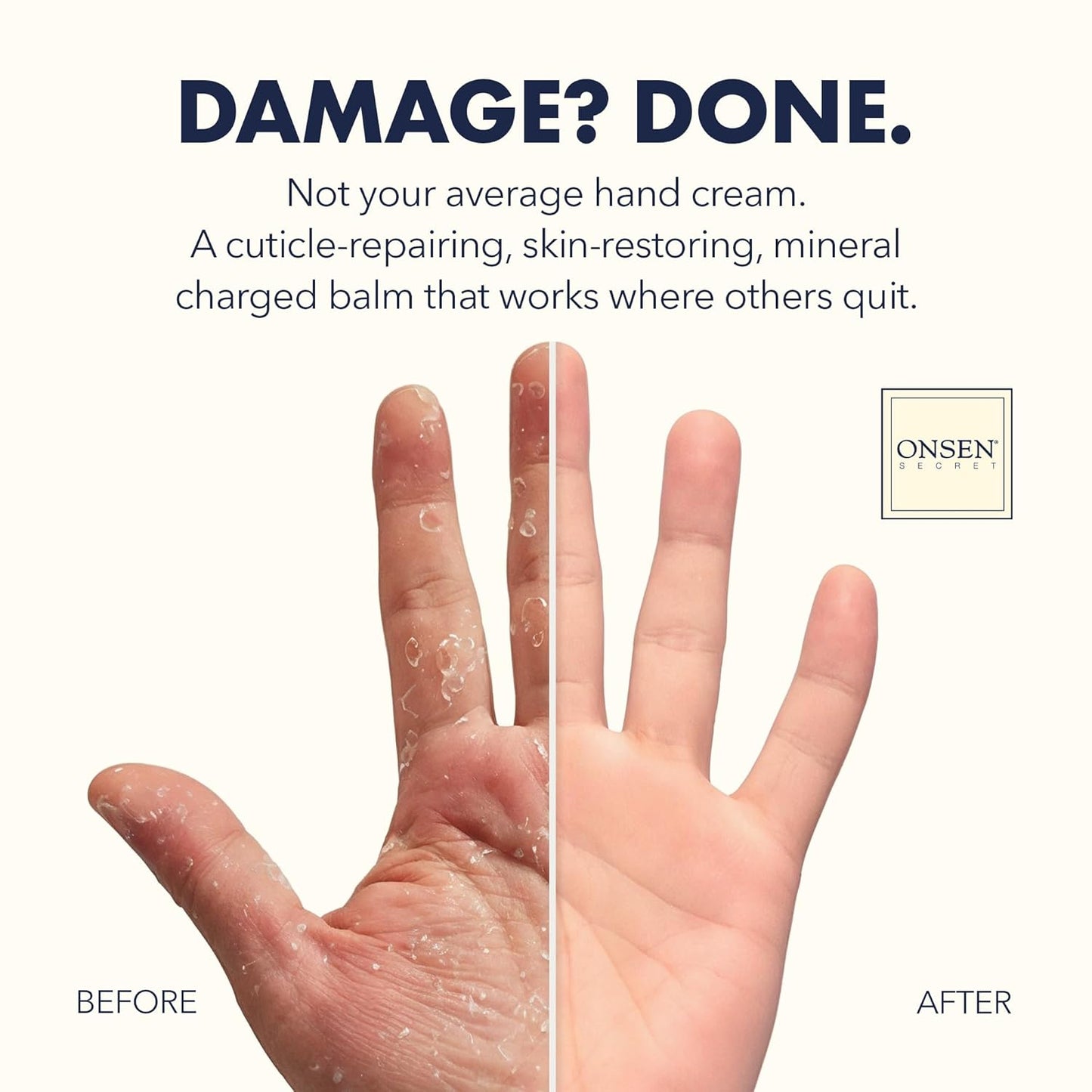 Onsen Nail & Cuticle Rescue Kit - Conditioner Serum, Repair Oil & Cuticle Balm - Tsubaki, Shea Butter, Jojoba - Strengthens Nails, Softens Cuticles, Hydrates Skin (15ml Serum + 10ml Oil + 26ml Cream)