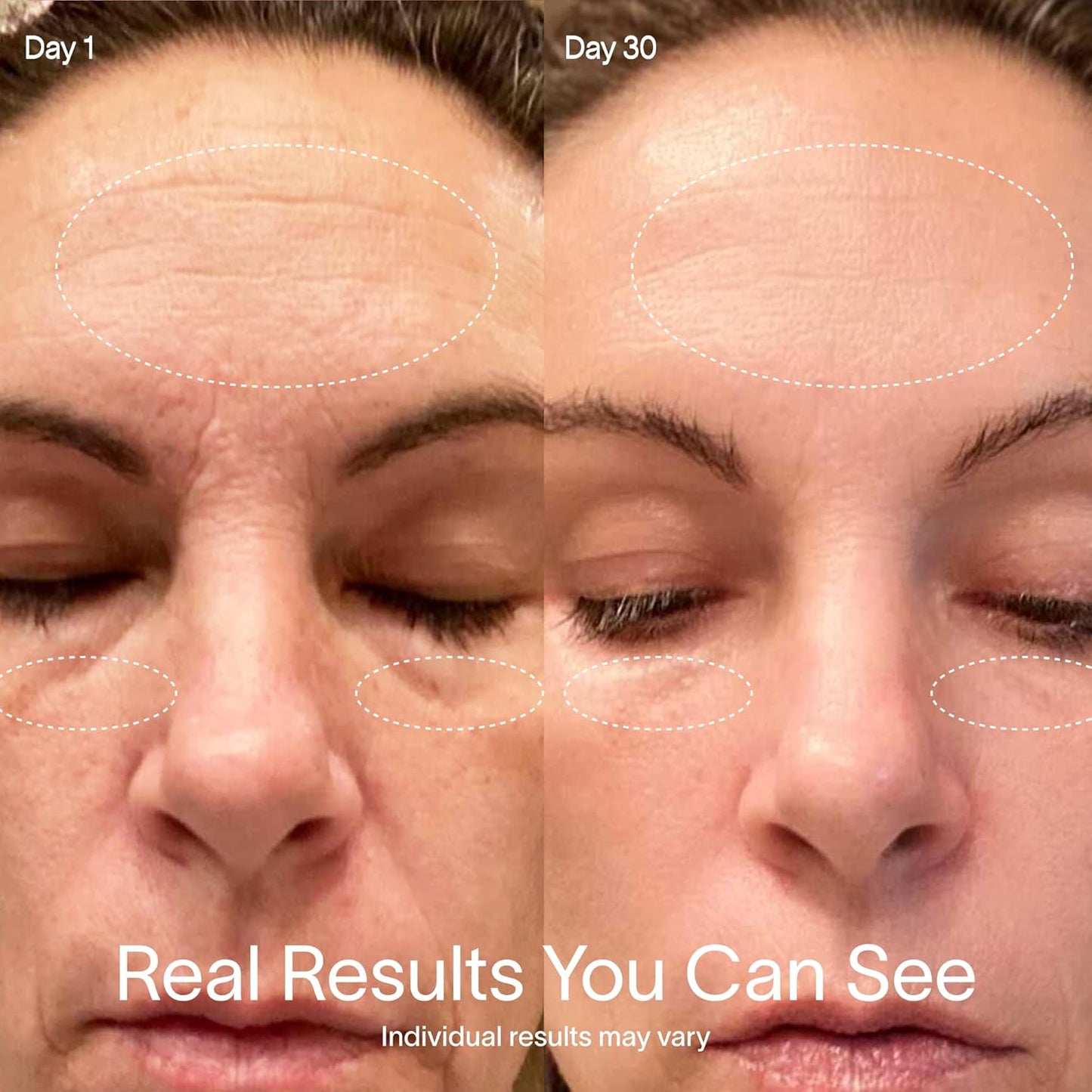 Solawave 4-in-1 Red Light Therapy Wand for Face & Neck | Beauty Device with Galvanic Current, Massager & Warmth | Anti-Aging, Wrinkle Reduction, Skin Tightening, Depuffing & Rejuvenation (Ombre)