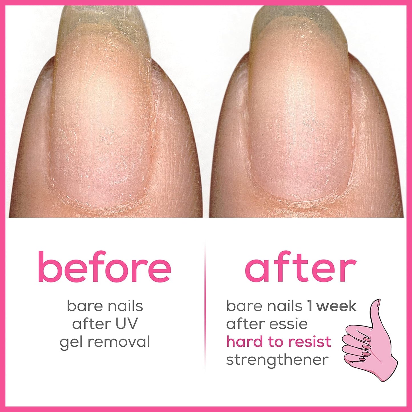Essie Nail Strengthening Set, Hard To Resist Nail Strengthener, Glow & Shine, Neutralize & Brighten, 0.46 Fl Oz Each