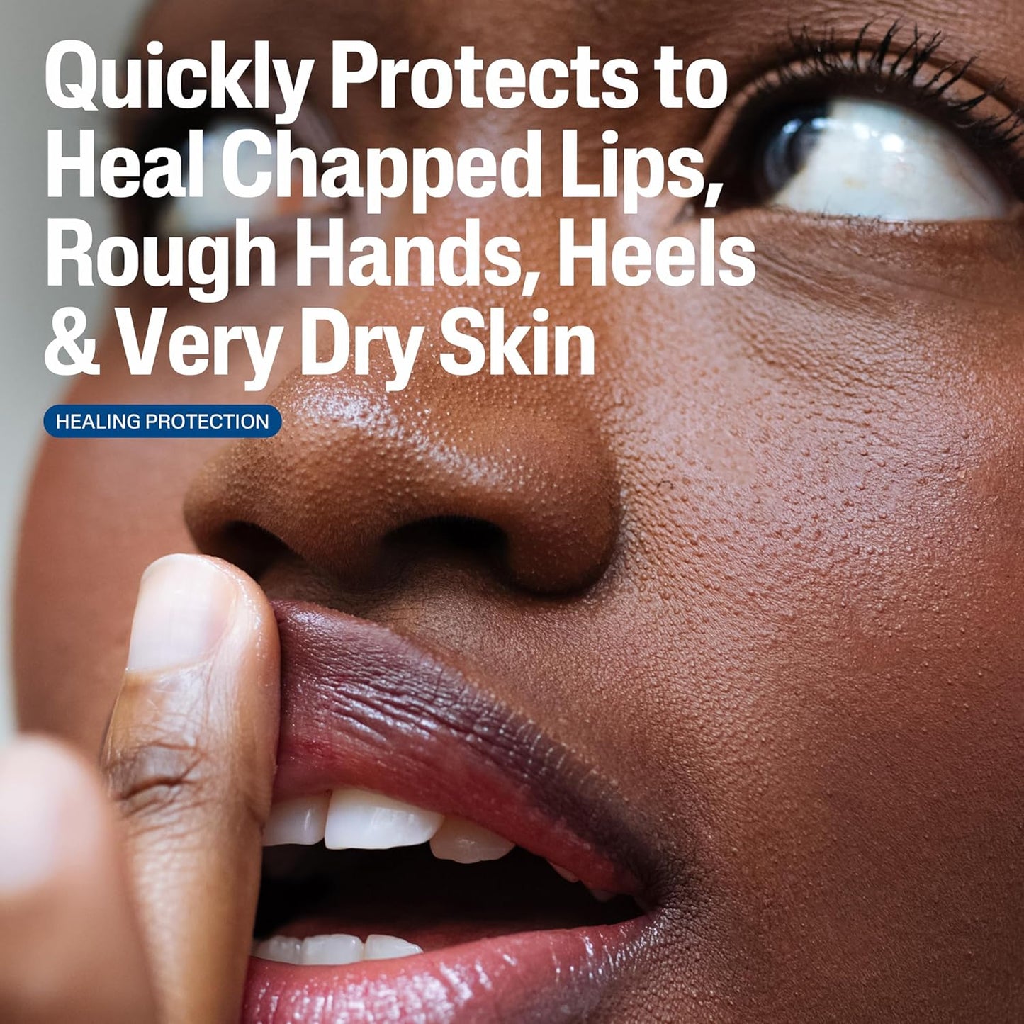 CETAPHIL Healing Ointment, 3 oz, For Dry, Chapped, Irritated Skin, Heals and Protects, Soothes Cracked Hands and Chapped Lips, Hypoallergenic, Fragrance Free